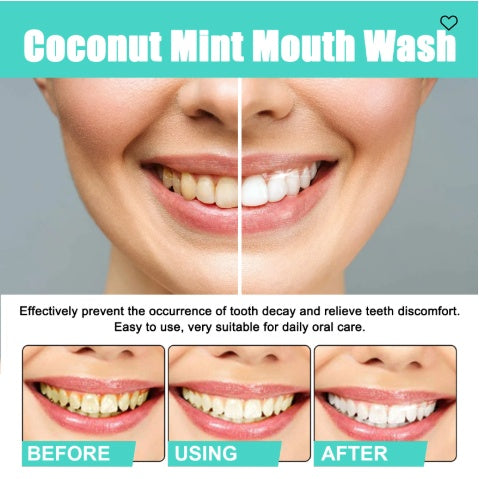 Coconut Mint Mouthwash for Fresh Breath and Whiter Teeth